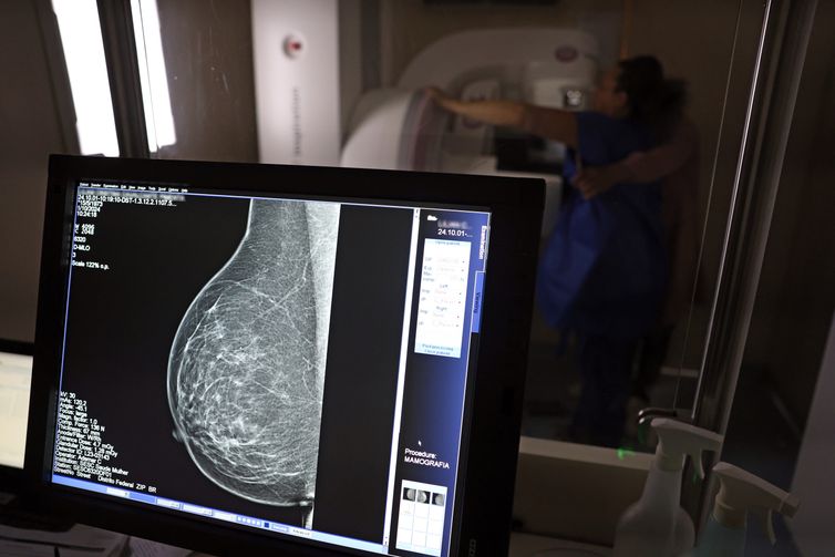 Cerca de 77 mil mulheres aguardam mamografia pelo SUS